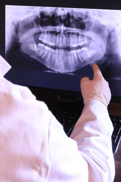 Best Emergency Tooth Extraction in Yorba Linda, CA